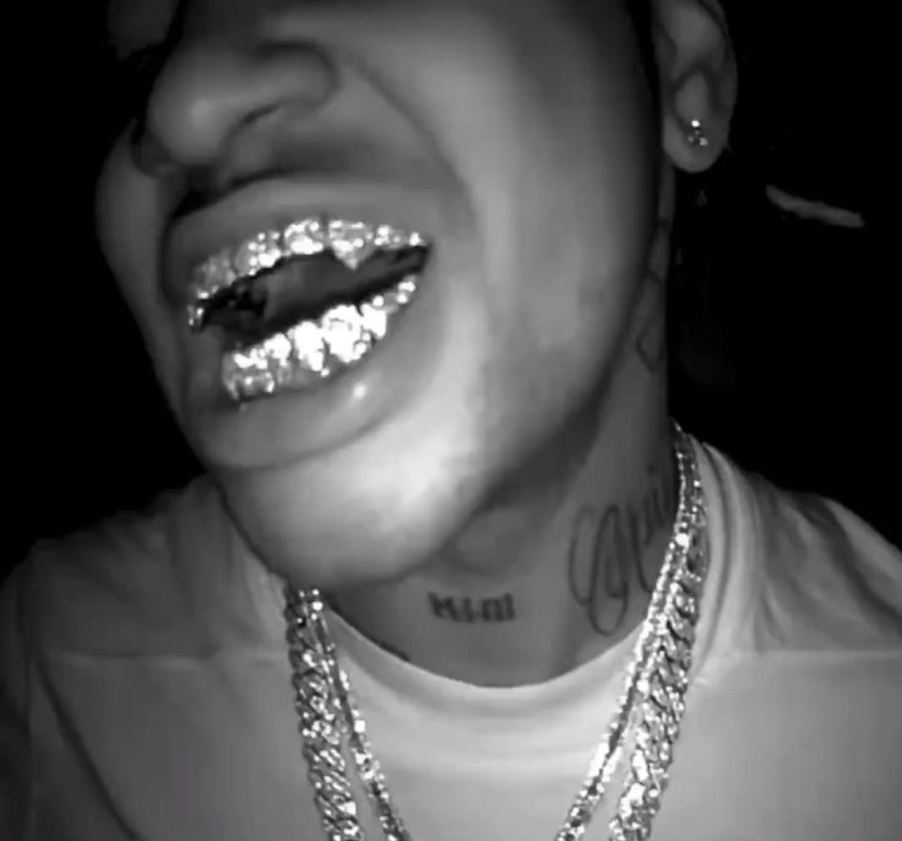 Ice diamond teeth